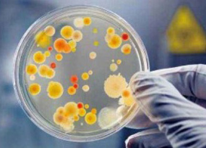 ԭλ�л���Ⱦ���ؽ���- ǿ��΢���ｨ��